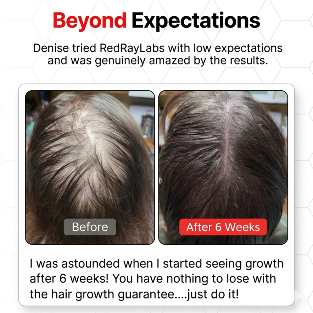 RedRayLabs™ Premier Laser Cap